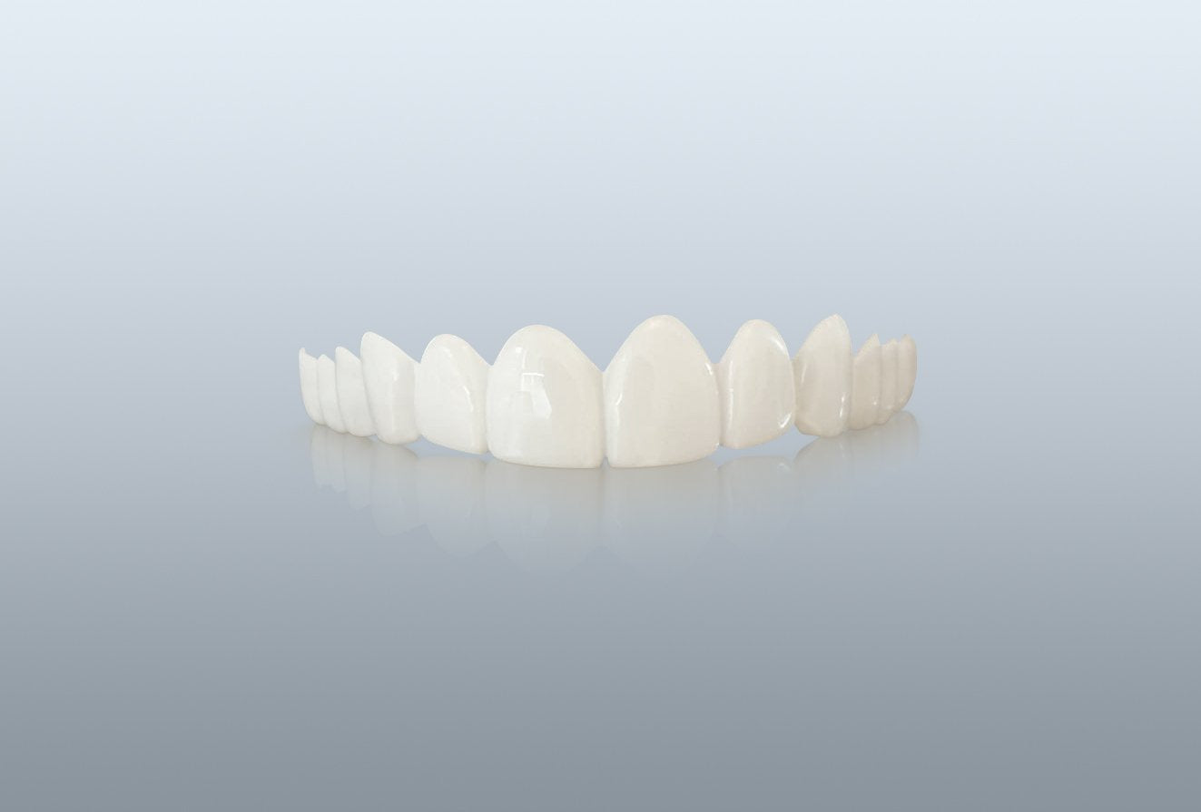 3 Day Express Ultra-Thin Veneers