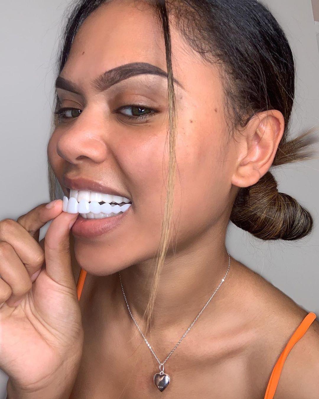 Express 3 Day Veneers, Full Set